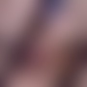 malacofacetaniemiala