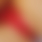 otwartauczciwaszczera